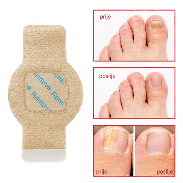 Elaimei™  Fungal Nail Patches